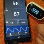 Фото к отзыву Михаил -ProZone oExpert SMART 