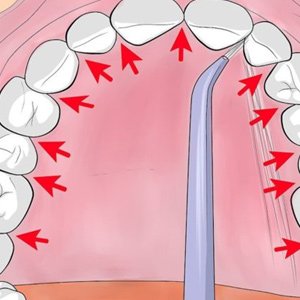 Как пользоваться ирригатором